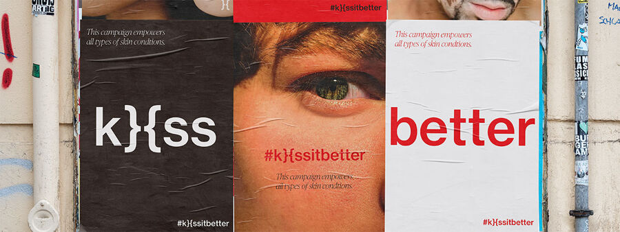 Bcu.Cict.CmsApi.Entities.Content.Corporate.Content.MediaItem?.AlternativeText