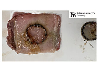 Emergency care experts explain why button batteries cause harm to children and adults