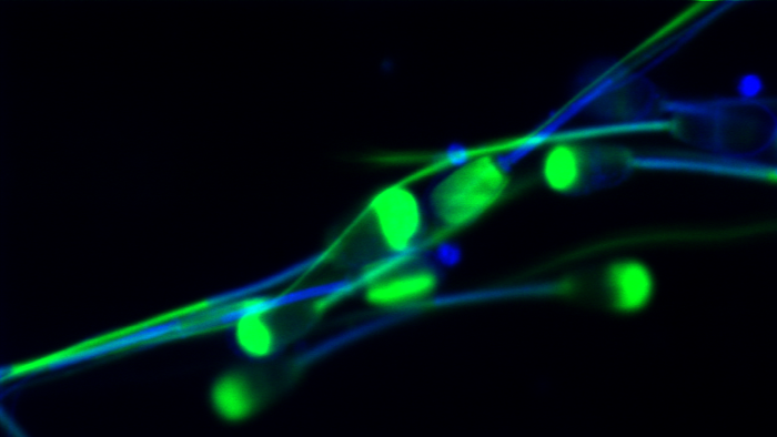 Conofocal Sperm Image